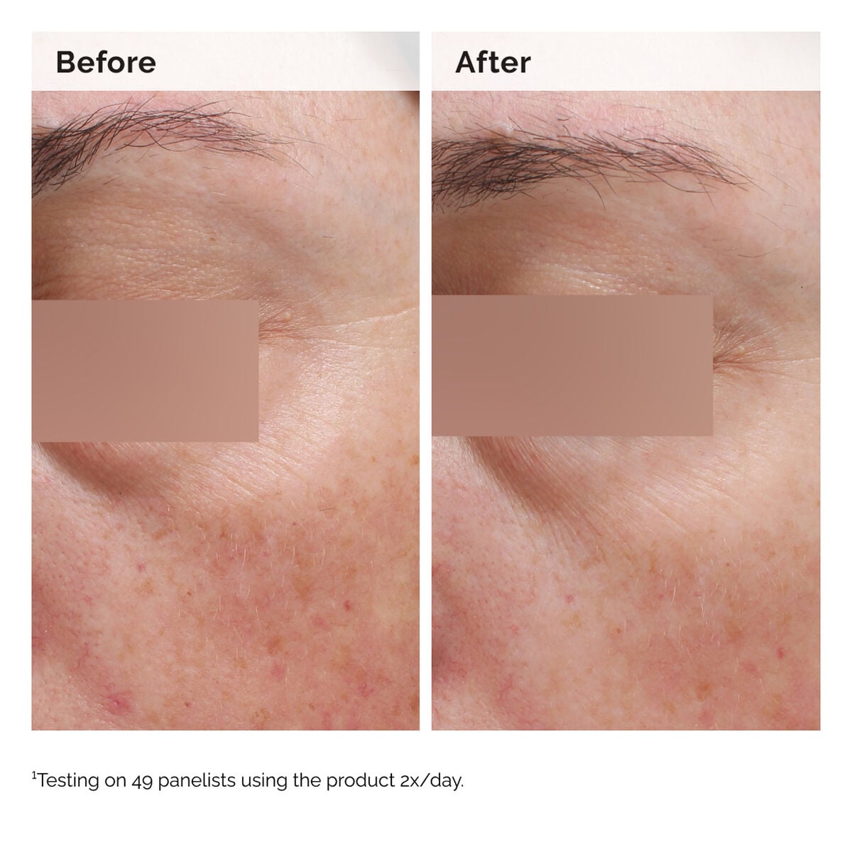 niacinamide-5-face-and-body-emulsion-s6 2024-08-23-ORD-Nia-5pct-Face-Body-B-A-Elasticity-Global-02-1x1.jpg