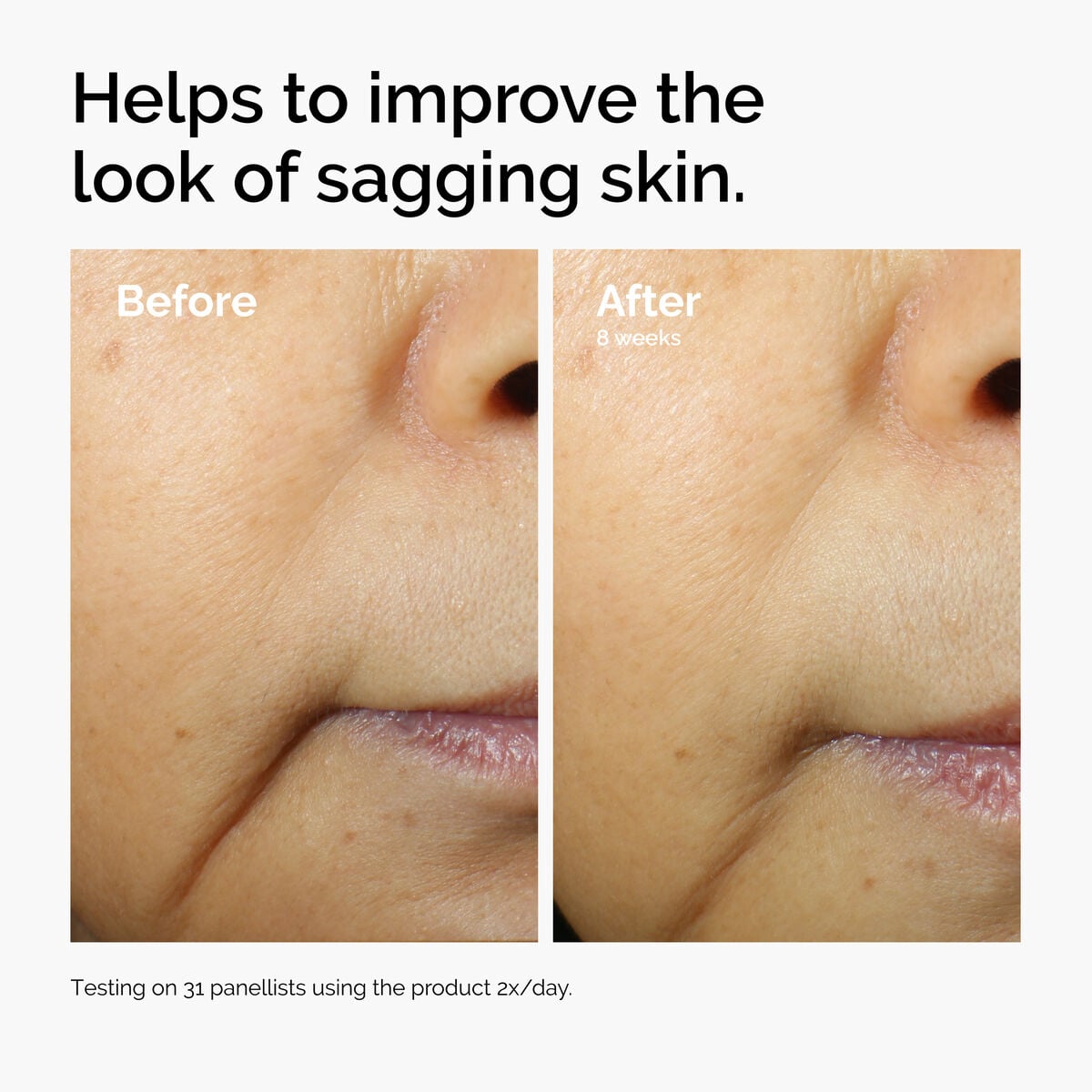 caffeine-3-escin-1-face-serum-o6 ord-caffeine-3pct-escin-1pct-face-serum-before-after-sagging.jpg