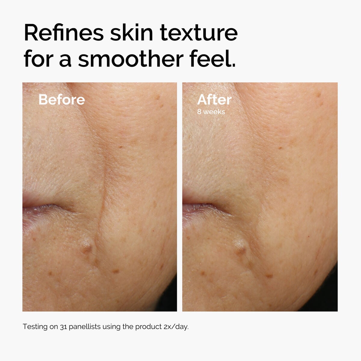 caffeine-3-escin-1-face-serum-o6 ord-caffeine-3pct-escin-1pct-face-serum-before-after-texture.jpg