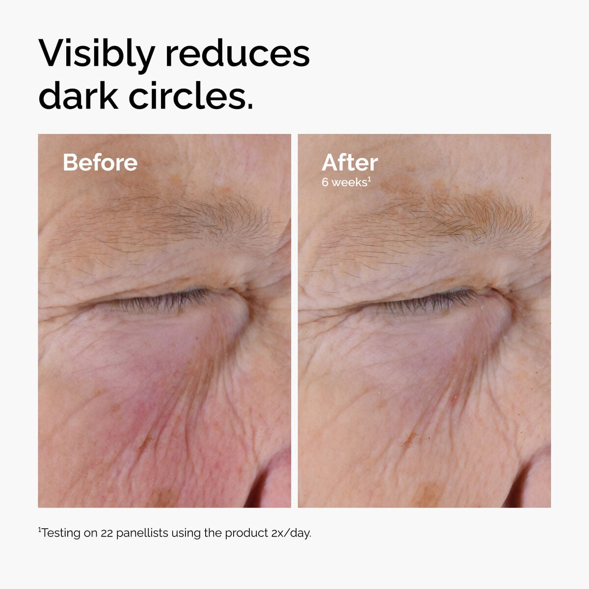 caffeine-solution-5-egcg-eye-serum-w5 ord-caffeine-solution-egcg-dark-circles-before-after.jpg