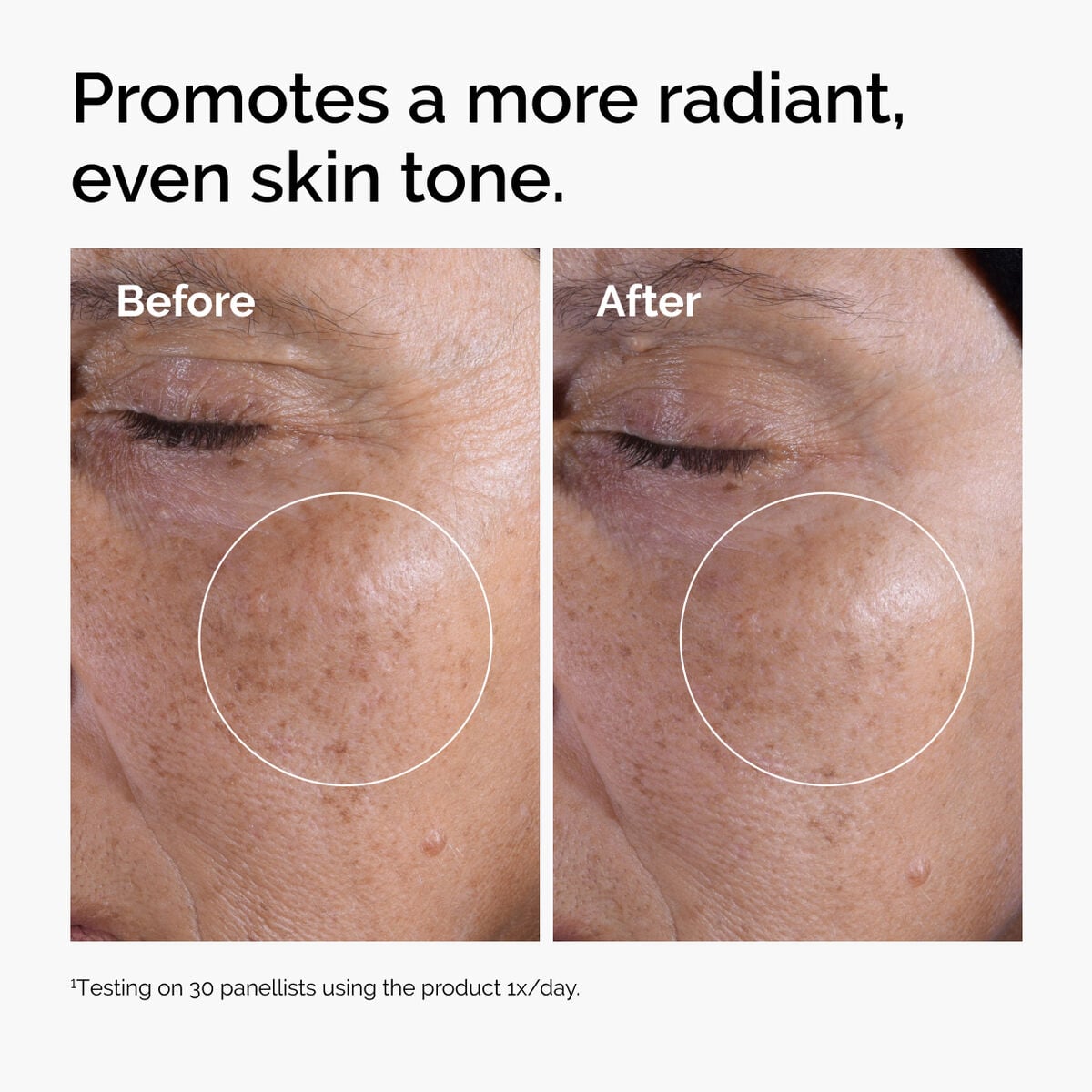 glycolic-acid-7-exfoliating-toner-n8 ord-glycolic-before-after-radiance.jpg