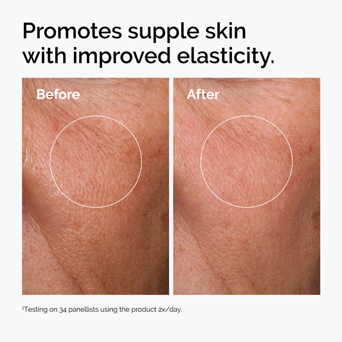 hyaluronic-acid-2-b5-with-ceramides-z9 ord-hyaluronic-acid-2pct-b5-hydrating-serum-before-after-elasticity.jpg