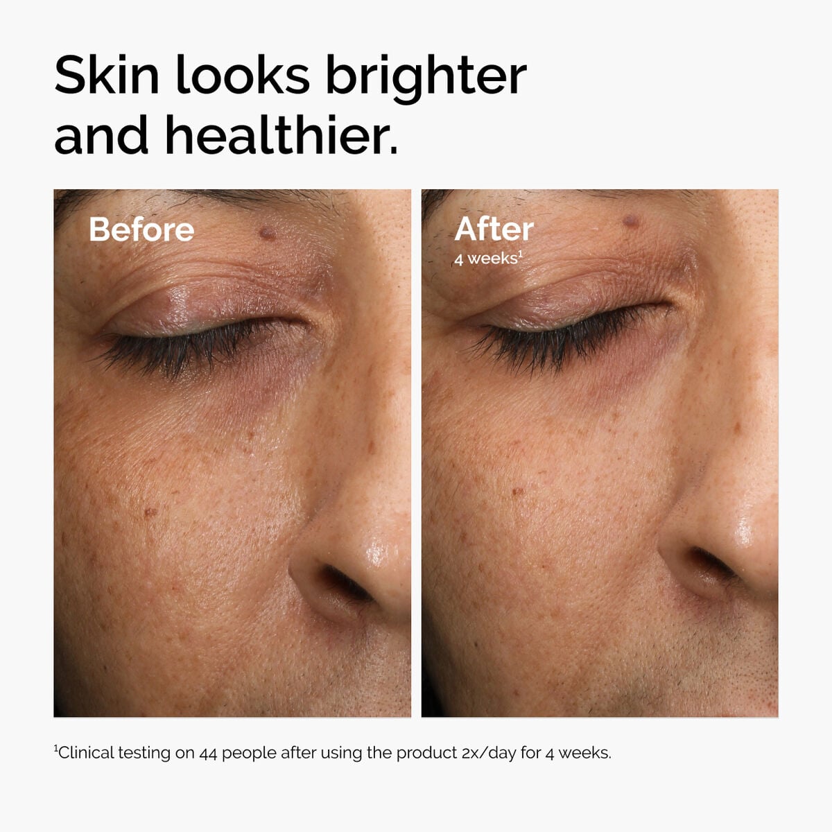 multi-antioxidant-radiance-serum-b1 ord-mars-before-after-healthy.jpg