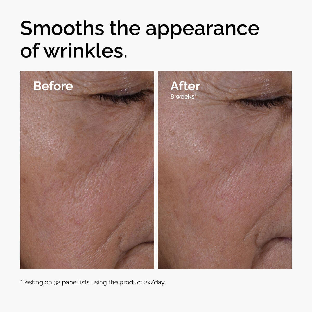 multi-peptide-ha-serum-n9 ord-multi-peptide-ha-serum-wrinkles-before-after.jpg