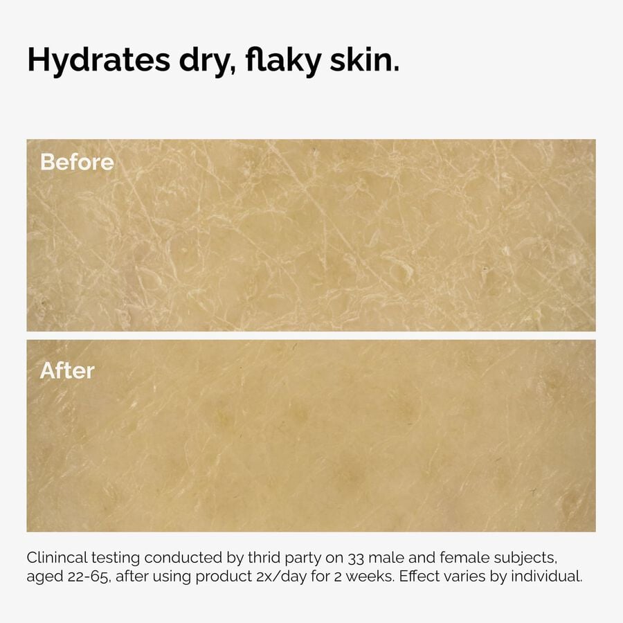 the-body-care-collection-p5 ord-natural-moisturizing-factors-inulin-body-before-after-graphic-02.jpg