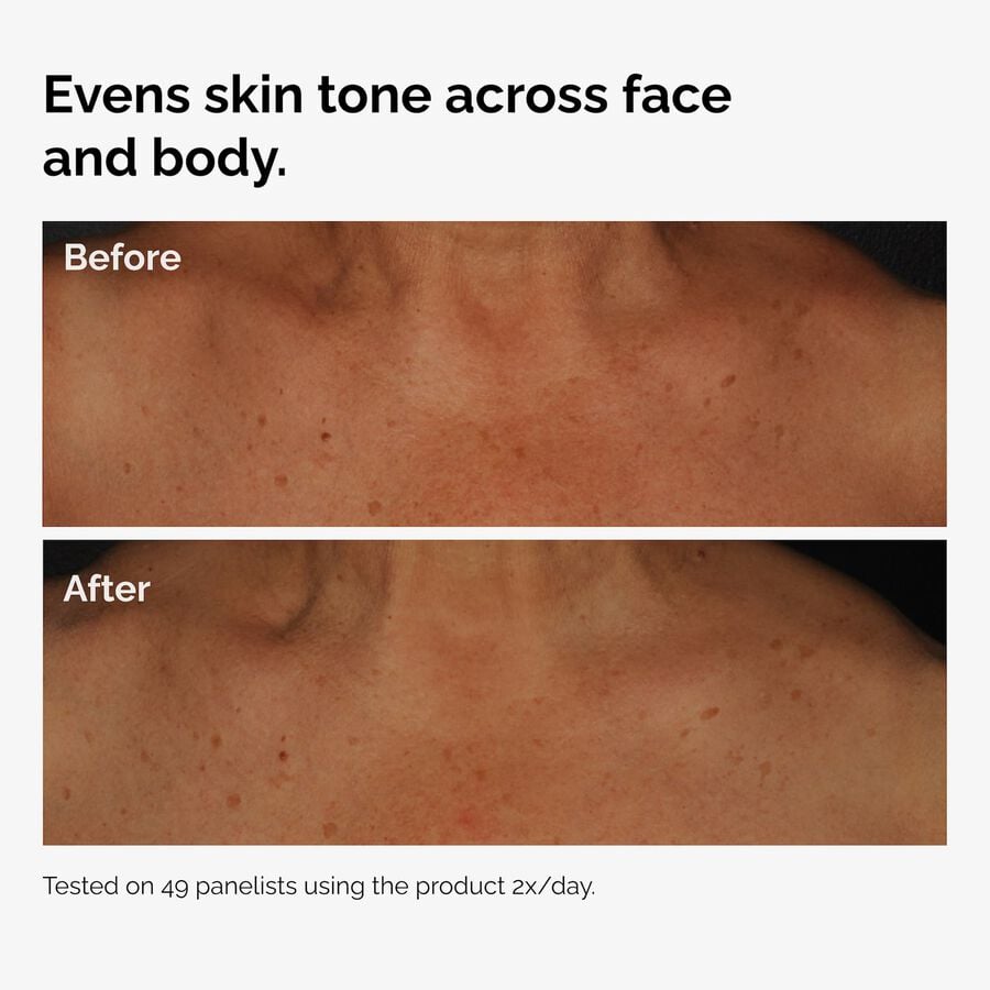 the-body-care-collection-p5 ord-niacinamide-face-body-serum-before-after-even-tone-graphic.jpg